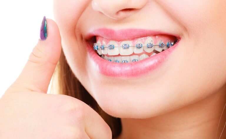 The Ultimate Guide To Orthodontics: How Does It Work?  