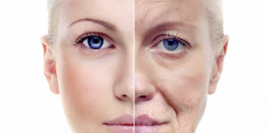 What Makes Laser Skin Treatment a Top Anti-Aging Solution?