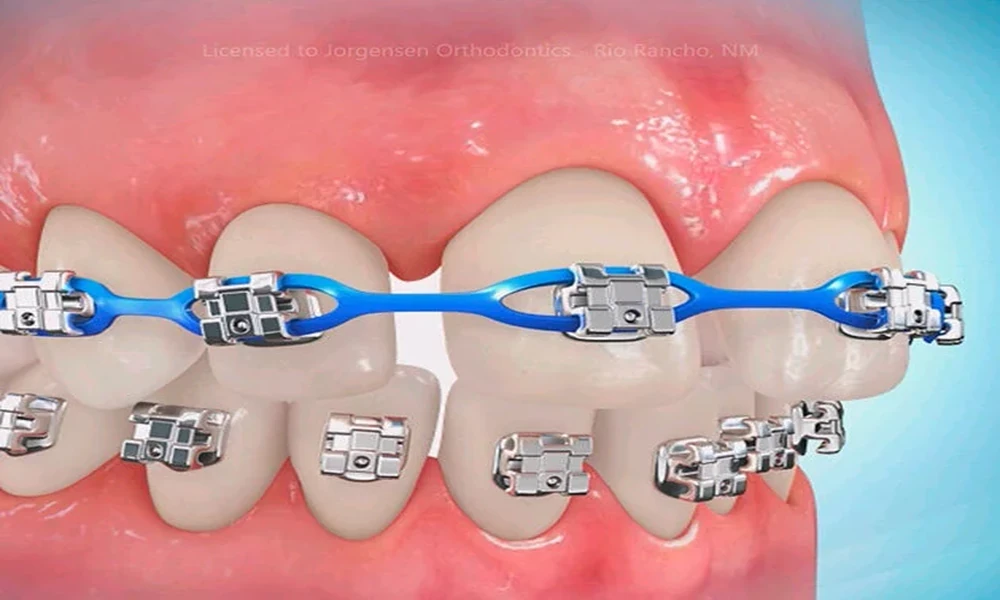 How General Dentists Evaluate Unusual Tooth Movement